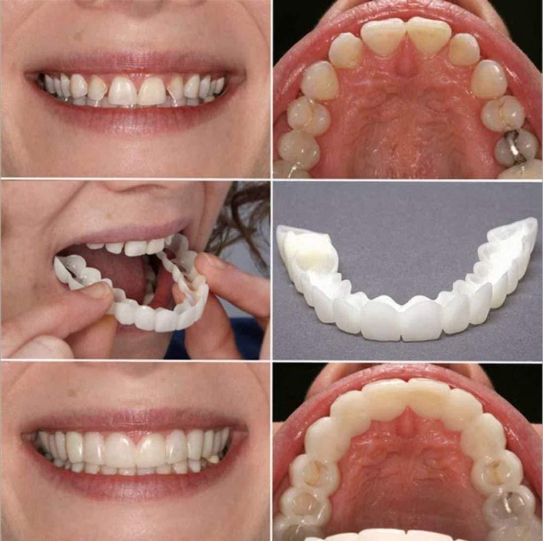 FIT FLEX ADJUSTABLE SNAP-ON DENTURES (Buy 1 Get 1 Free🔥🔥)
