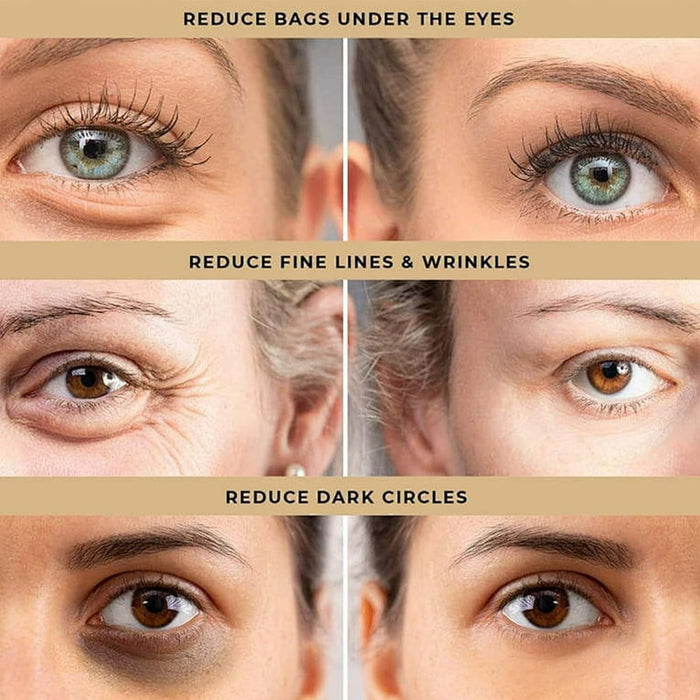 Skin Mantra™ Anti-Wrinkle Serum 🔥(Buy 1 Get 1 Free)🔥 (Pack Of 2)