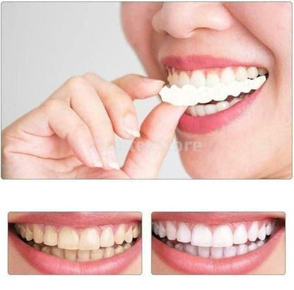 FIT FLEX ADJUSTABLE SNAP-ON DENTURES (Buy 1 Get 1 Free🔥🔥)